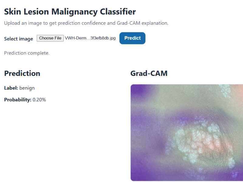 Skin-Lesion-Malignancy-Classifier